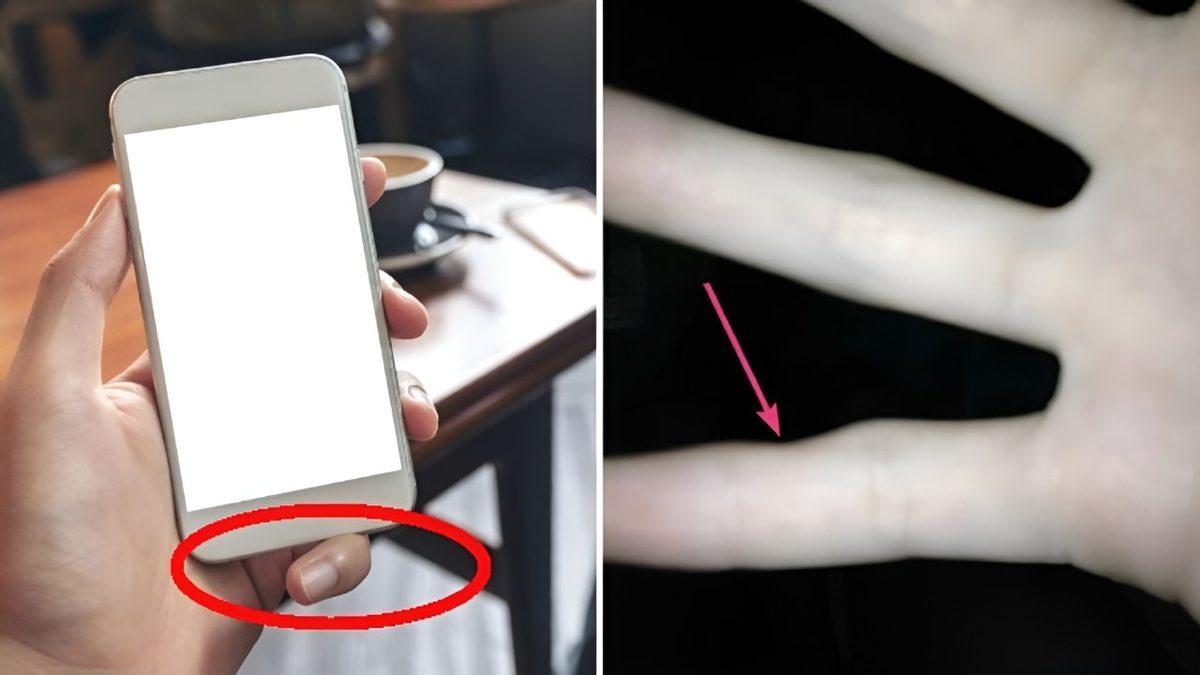 Artık Size Tek Elle Telefon Tutmayı Bıraktıracak İlginç Rahatsızlık: Smartphone Pinky