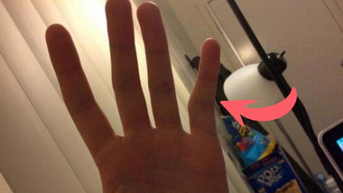 Artık Size Tek Elle Telefon Tutmayı Bıraktıracak İlginç Rahatsızlık: Smartphone Pinky