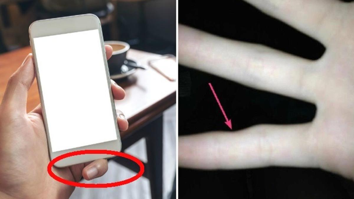Artık Size Tek Elle Telefon Tutmayı Bıraktıracak İlginç Rahatsızlık: Smartphone Pinky