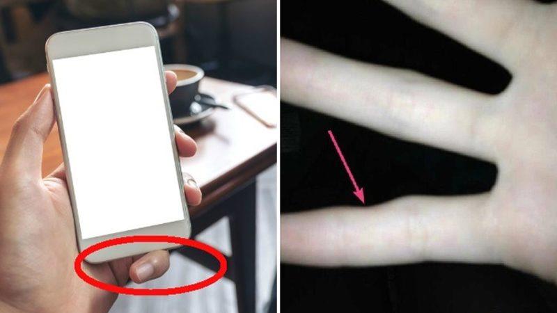Artık Size Tek Elle Telefon Tutmayı Bıraktıracak İlginç Rahatsızlık: Smartphone Pinky