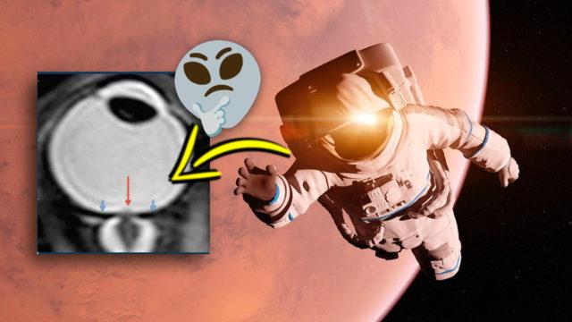 Uzayda Biraz Zaman Geçiren Astronotların Göz Bebeklerinin Şeklinin Değişmesinin Sebebi Ne?