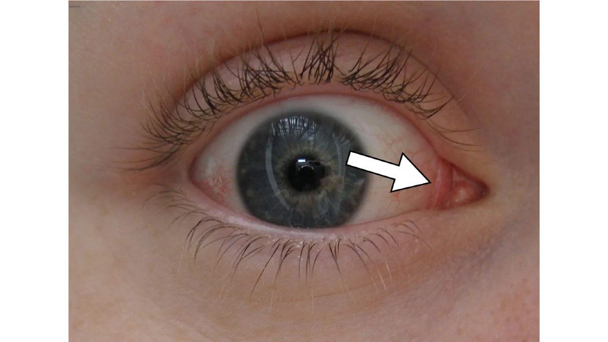 Bilmeden Yaşıyoruz: İşte Adını Bile Duymadığımız, Vücudumuzun 20 Gizemli Yeri