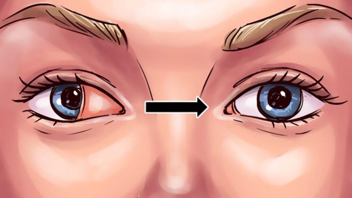 Yüzyıllar Önce Başka Bir Şey Olup Sonradan Küçülen, Gözümüzün Kenarındaki Bu Pembe Şey Ne?