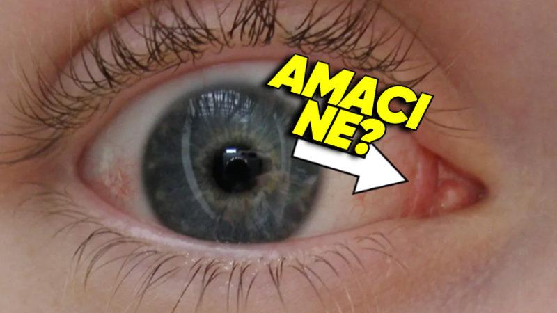 Yüzyıllar Önce Başka Bir Şey Olup Sonradan Küçülen, Gözümüzün Kenarındaki Bu Pembe Şey Ne?