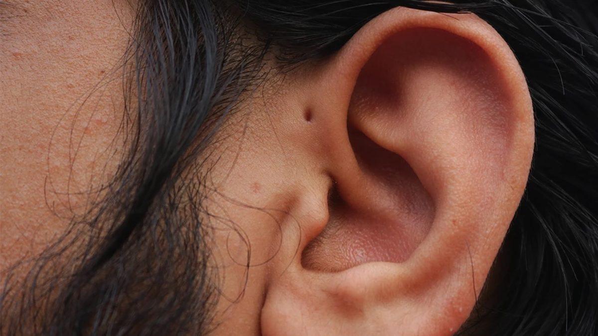 Bazılarımızın Kulağının Yanındaki Bu Minik İz Neyin Nesi? Piercing İzi Falan Değil!