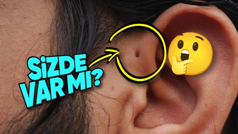 Bazılarımızın Kulağının Yanındaki Bu Minik İz Neyin Nesi? Piercing İzi Falan Değil!