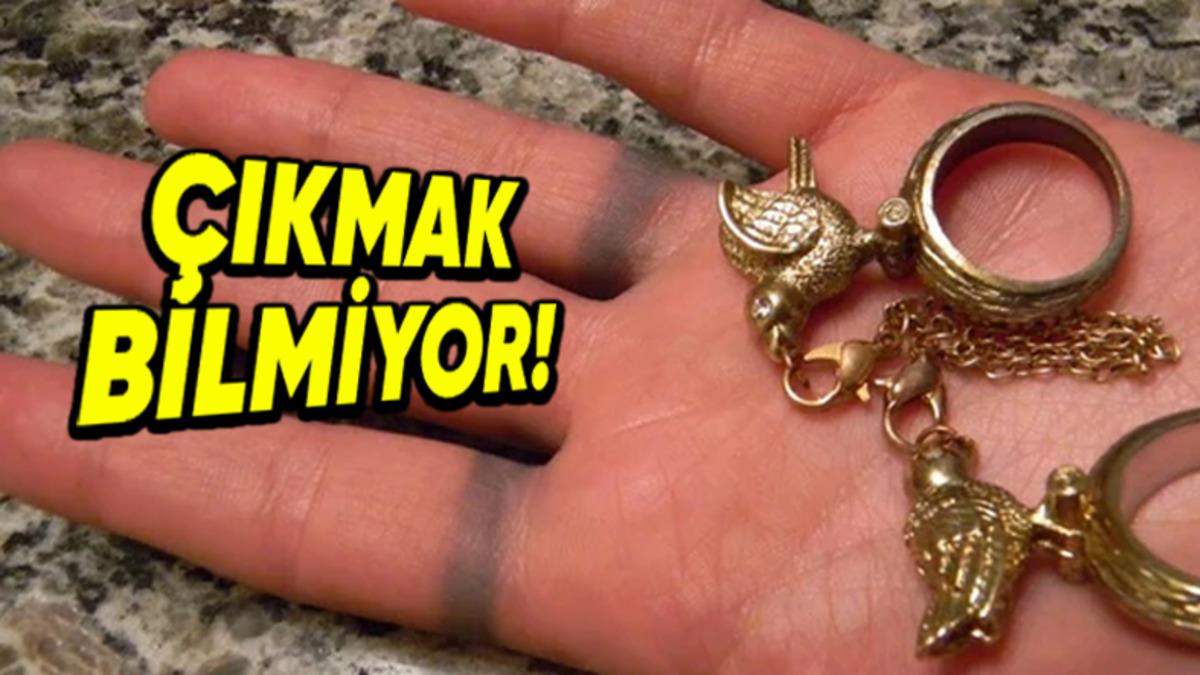 Bilimsel Bir Sebebi Var: Sahte Takılar Kullanıldıktan Bir Süre Sonra Neden Cildinizi Yeşile veya Siyaha Boyar?