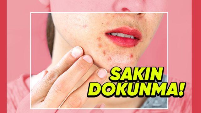 Sivilcelerinizi Patlatınca Cildinizde Neler Olduğunu Öğrenince Onlara Bir Daha Dokunmak İstemeyeceksiniz!