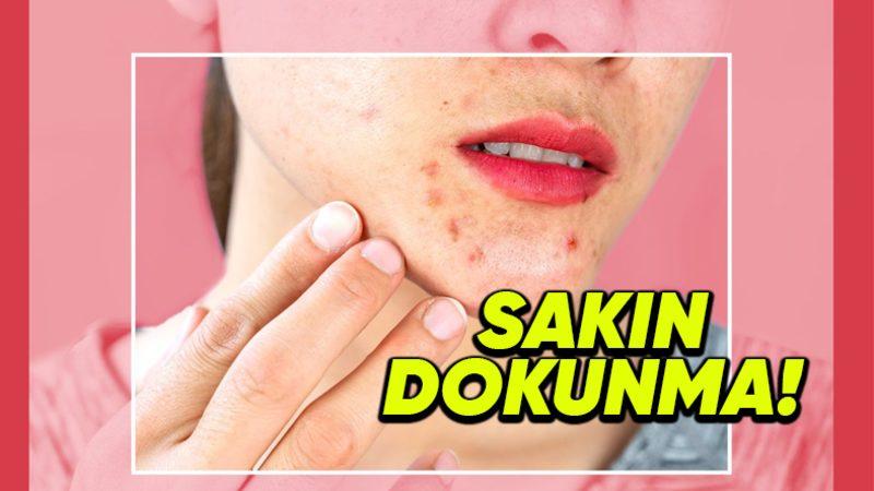 Sivilcelerinizi Patlatınca Cildinizde Neler Olduğunu Öğrenince Onlara Bir Daha Dokunmak İstemeyeceksiniz!