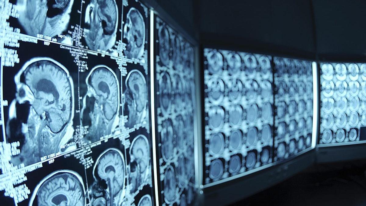 Pilotların ve Radyologların Sadece Süs Amaçlı Değilmiş Dedirten Kırmızı Gözlük Takma Sebepleri Neler?