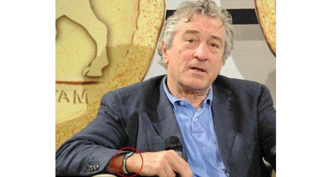 Bir Dönem Belediye Dağıtmış Gibi Herkesin Bileğinde Olan Denge Bilekliklerine Ne Oldu?