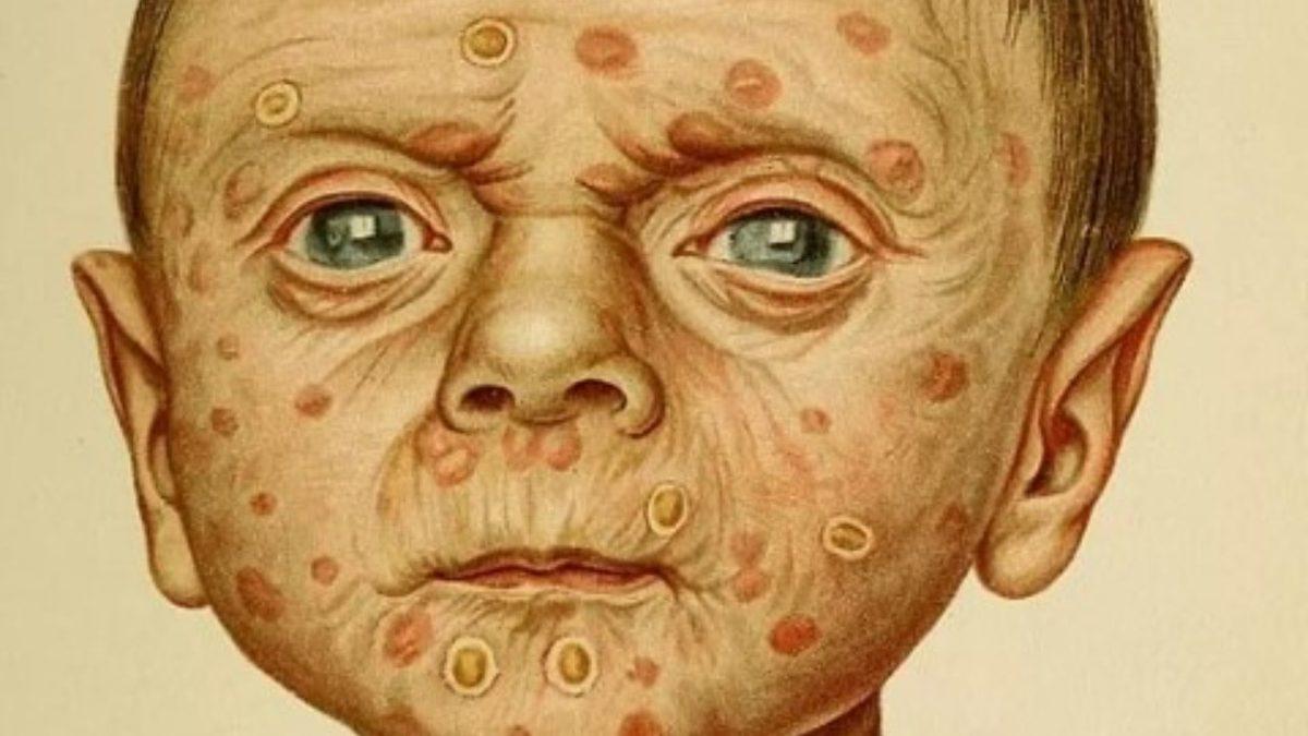 Orta Çağ, Neden Dünya Tarihinde Hayatta Kalması En Zor Dönemlerden Biriydi? Adım Attığınız Yer Tehlikeymiş!