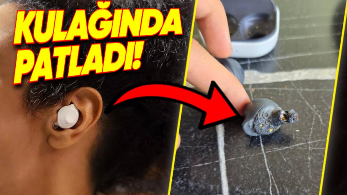 Bir Türk Kullanıcı, Samsung Galaxy Buds FE’nin Kulağında Patladığını ve Kalıcı İşitme Kaybına Neden Olduğunu İddia Etti