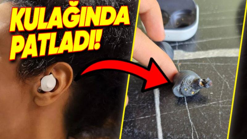 Bir Türk Kullanıcı, Samsung Galaxy Buds FE’nin Kulağında Patladığını ve Kalıcı İşitme Kaybına Neden Olduğunu İddia Etti