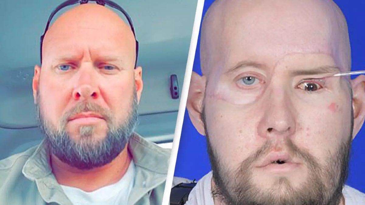 Diğer Organları Normalleştirdik, Peki Ya ’Göz Nakli’ Mümkün mü?