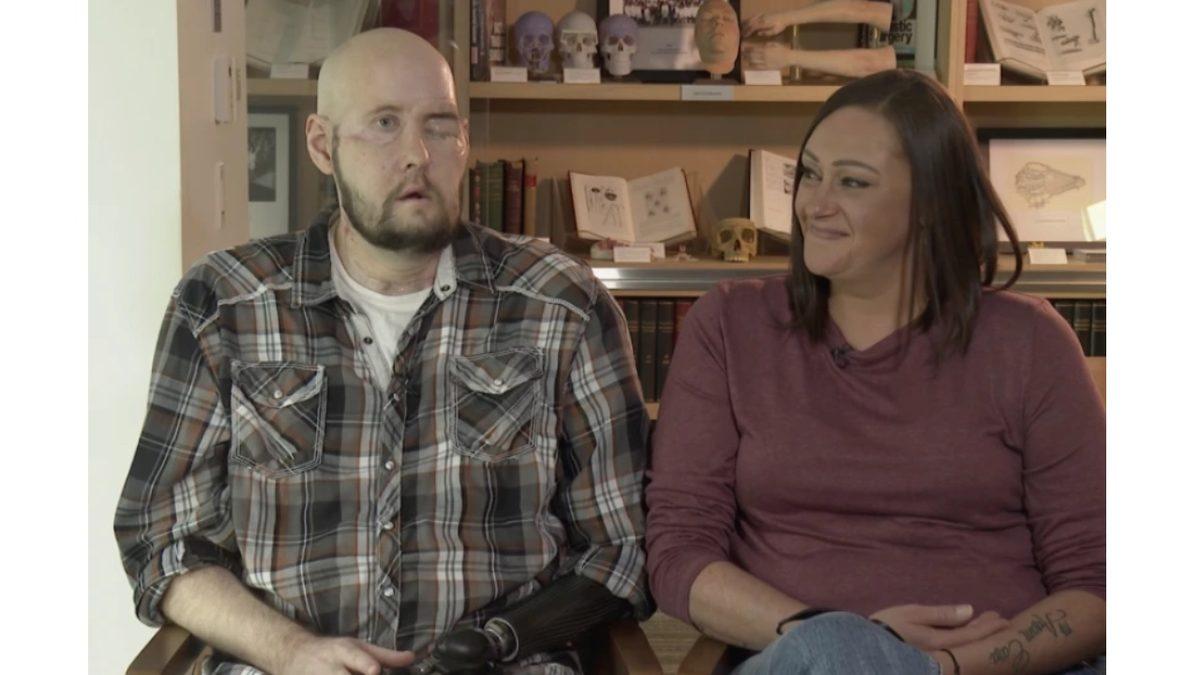 Diğer Organları Normalleştirdik, Peki Ya ’Göz Nakli’ Mümkün mü?