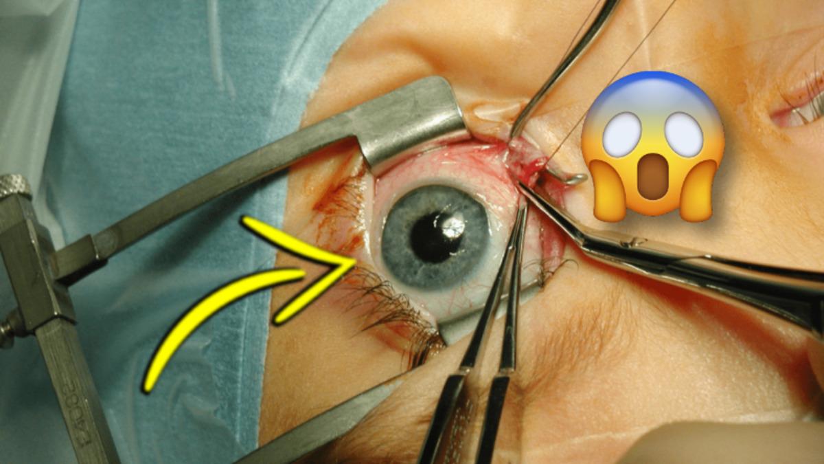 Diğer Organları Normalleştirdik, Peki Ya ’Göz Nakli’ Mümkün mü?