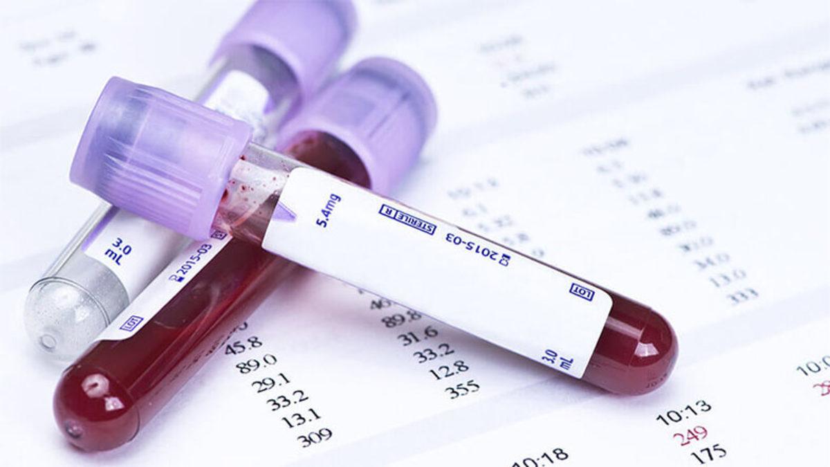 Bir Kişiye Kendi Kan Grubu Dışında Bir Gruptan Kan Nakli Yapılırsa Neler Olur? Düşünmek Bile İstemezsiniz!