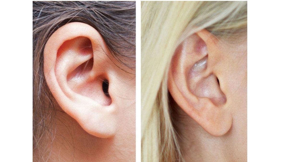 Herhangi Bir İşlevi Olmamasına Rağmen Neden Kulak Memelerimiz Var? (Küpe Takalım Diye Değil Herhalde...)