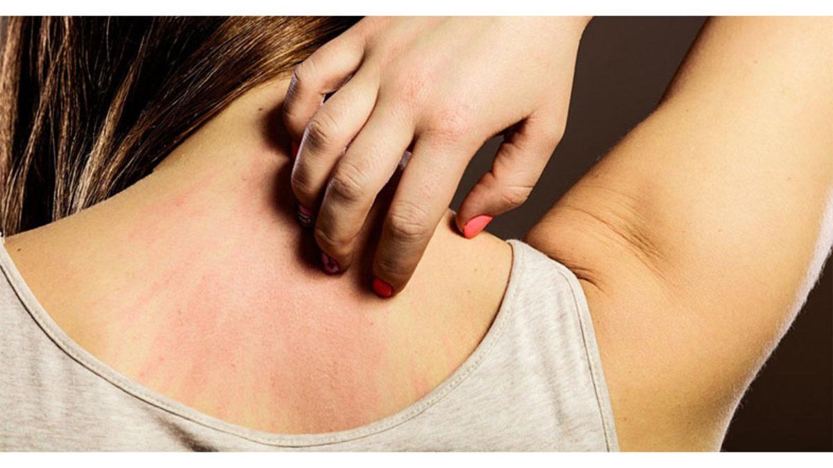 Vücudun Bir Yerini Kaşırken Neden O Kaşıntıyı Çok Alakasız Bir Yerde Hissediyoruz?