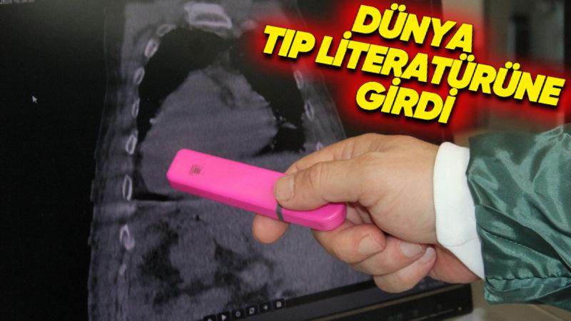 Giresun’da Dünyada İlk Kez Görülen Bir Hastalık Keşfedildi: "Giresun Sendromu" Olarak Tıp Literatürüne Girdi!