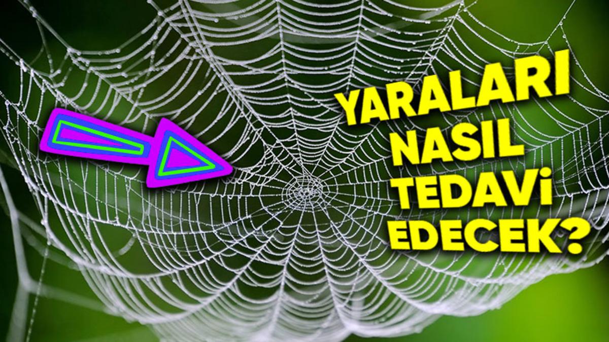 Bilime Göre Kronik Yaraların Tedavisinde Bundan Sonra "Örümcek Ağı" Kullanabiliriz: İyi de Neden?