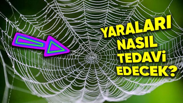 Bilime Göre Kronik Yaraların Tedavisinde Bundan Sonra "Örümcek Ağı" Kullanabiliriz: İyi de Neden?