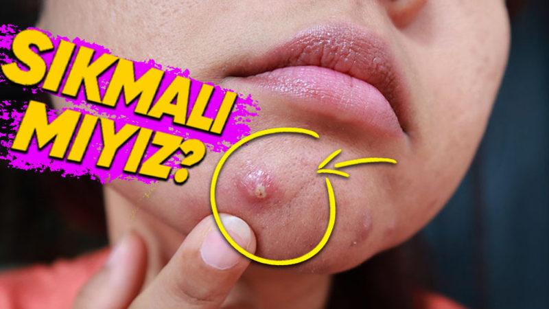 Sivilceyi Sıkmak Gerçekten de İz Bırakıyor mu Yoksa Sadece Bir Efsaneden mi İbaret? (Bırakıyorsa Neden?)