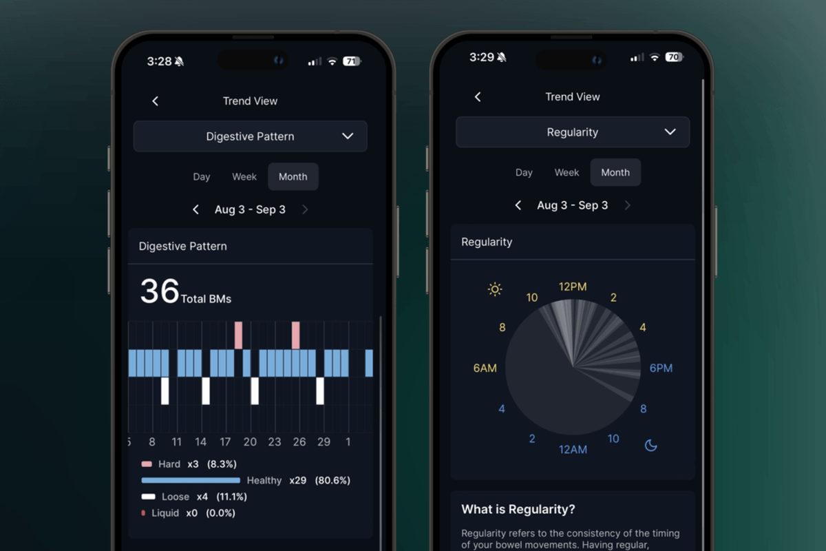 Tuvaletten Çıktığımızda Dışkımızın Fotoğrafını Çeken Tuvalet Kamerası Tanıtıldı