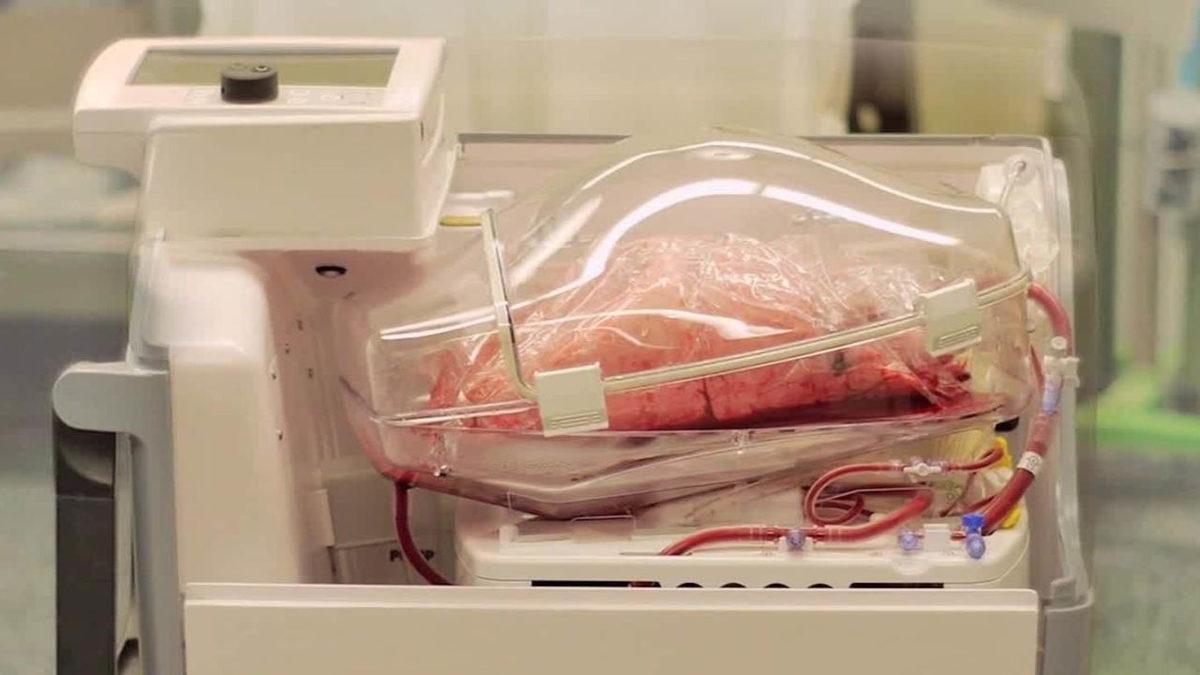 Beyin Ölümü Gerçekleştiği Düşünülen Bir Adamın Organları Alınırken Uyandığı Ortaya Çıktı