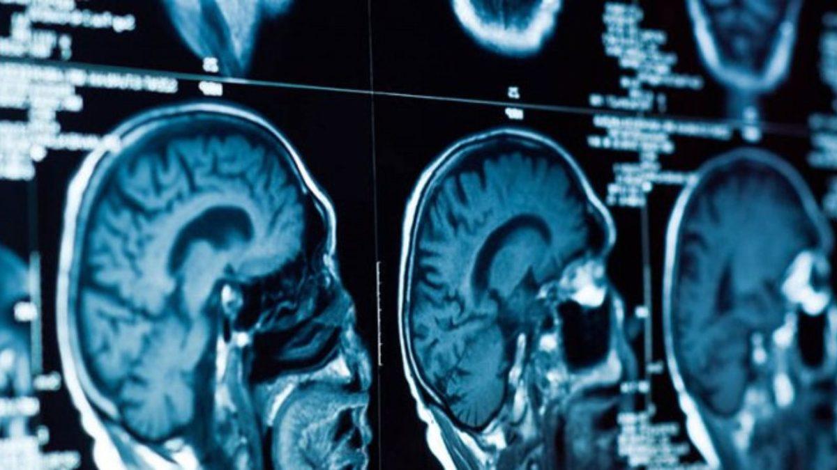 Bilime Göre İlk Defa Çocuk Sahibi Erkeklerin Beyinleri %1-%2 Oranında Küçülüyor! Peki Neden ve Nasıl?