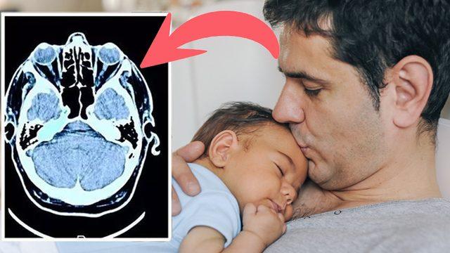 Bilime Göre İlk Defa Çocuk Sahibi Erkeklerin Beyinleri %1-%2 Oranında Küçülüyor! Peki Neden ve Nasıl?
