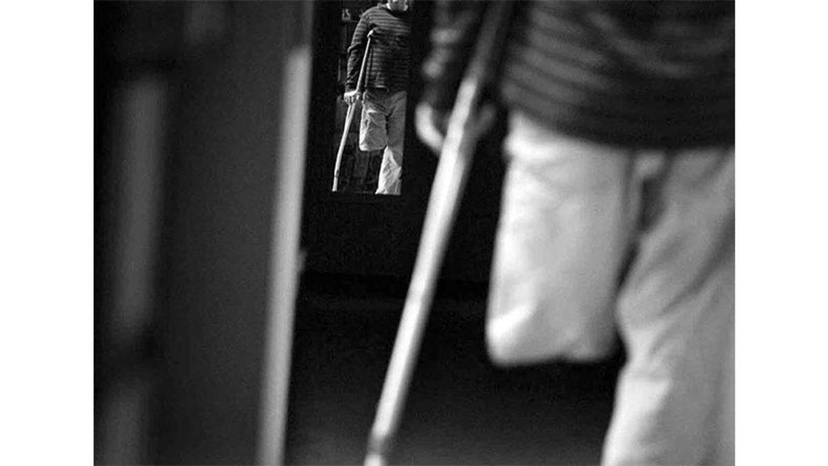 Bildiğiniz Tüm Korkunç Psikolojik Rahatsızlıkları Unutun: Beden Bütünlüğünü Bozma Arzusu Taşıyan 