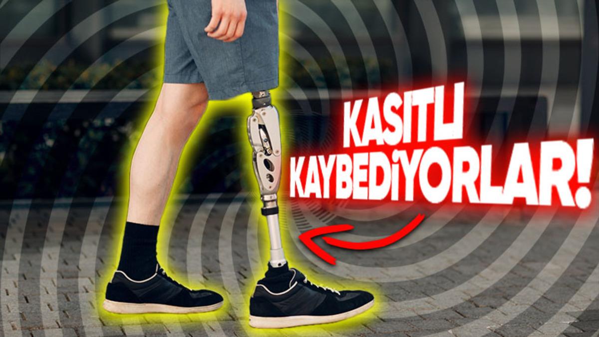 Bildiğiniz Tüm Korkunç Psikolojik Rahatsızlıkları Unutun: Beden Bütünlüğünü Bozma Arzusu Taşıyan "Apotemnofili" Nedir?