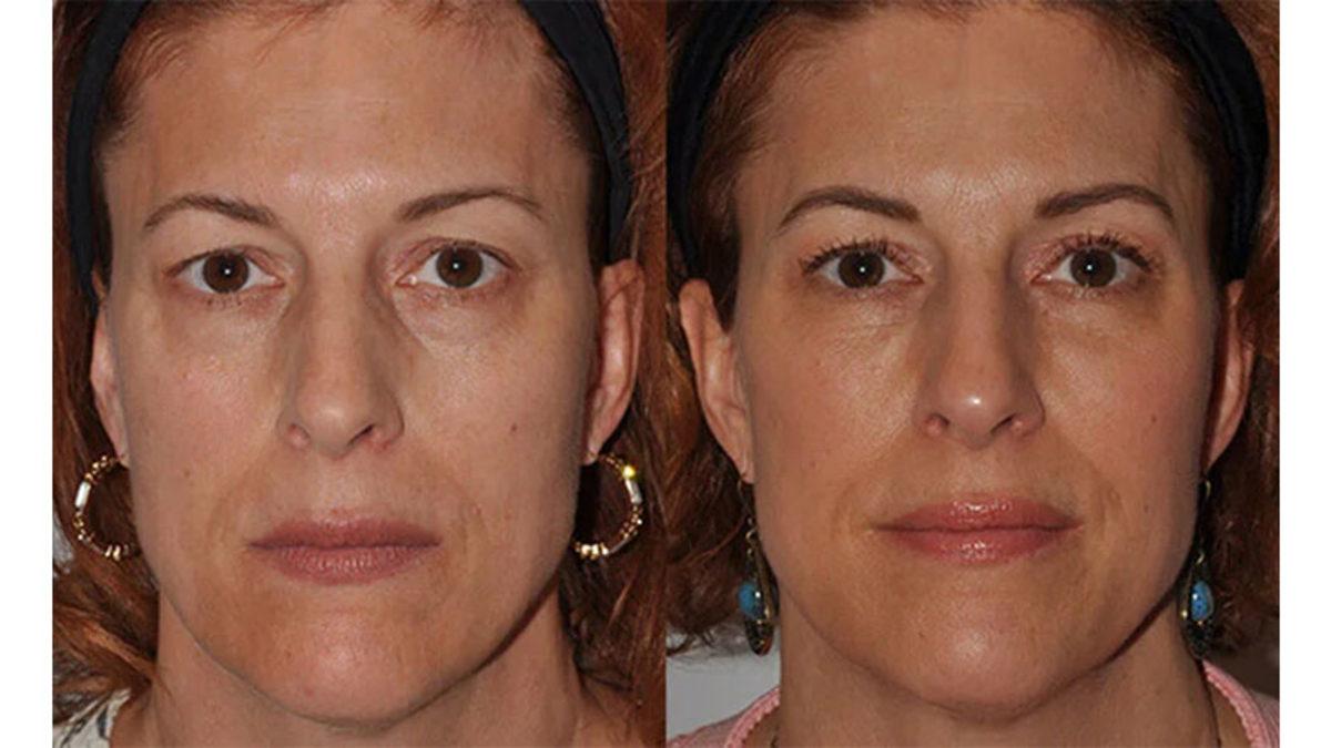 Yer Çekimi Vücudumuzun Yaşlanmasını Nasıl Etkiliyor? (Sonuç Biraz Canınızı Sıkabilir)