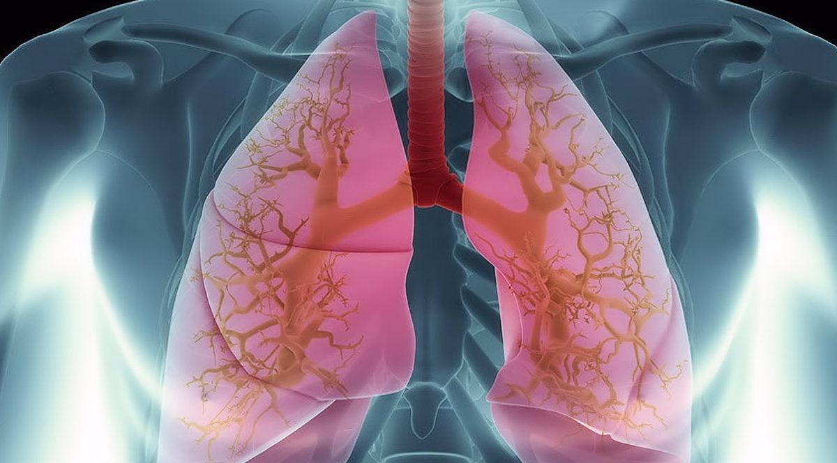 Genel Anesteziden Önce Neden Bir Şeyler Yiyip İçmemiz İstenmiyor? Ciddi Sebepleri Var!