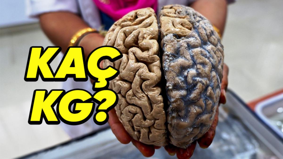 Guinness Dünya Rekorları’na Göre Dünyanın En Ağır Beynine Sahip Olan Adam İle Tanışın: Peki Kaç Kilogram?