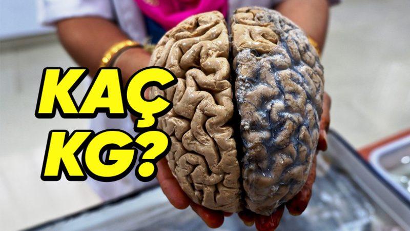 Guinness Dünya Rekorları’na Göre Dünyanın En Ağır Beynine Sahip Olan Adam İle Tanışın: Peki Kaç Kilogram?