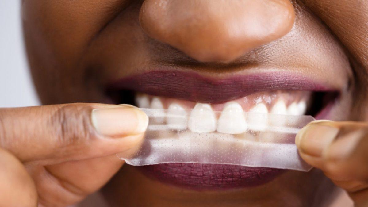 Sararan Dişleri Beyazlatmak İçin Diş Beyazlatıcıları Kullanmak Ne Kadar Doğru?