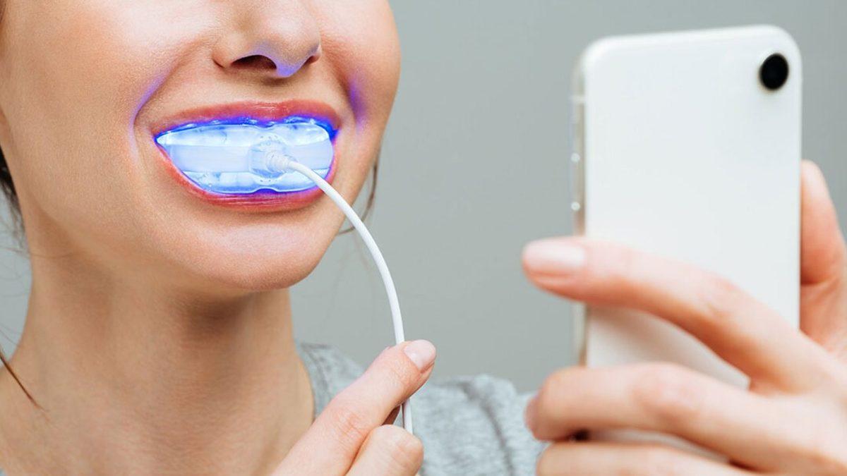 Sararan Dişleri Beyazlatmak İçin Diş Beyazlatıcıları Kullanmak Ne Kadar Doğru?