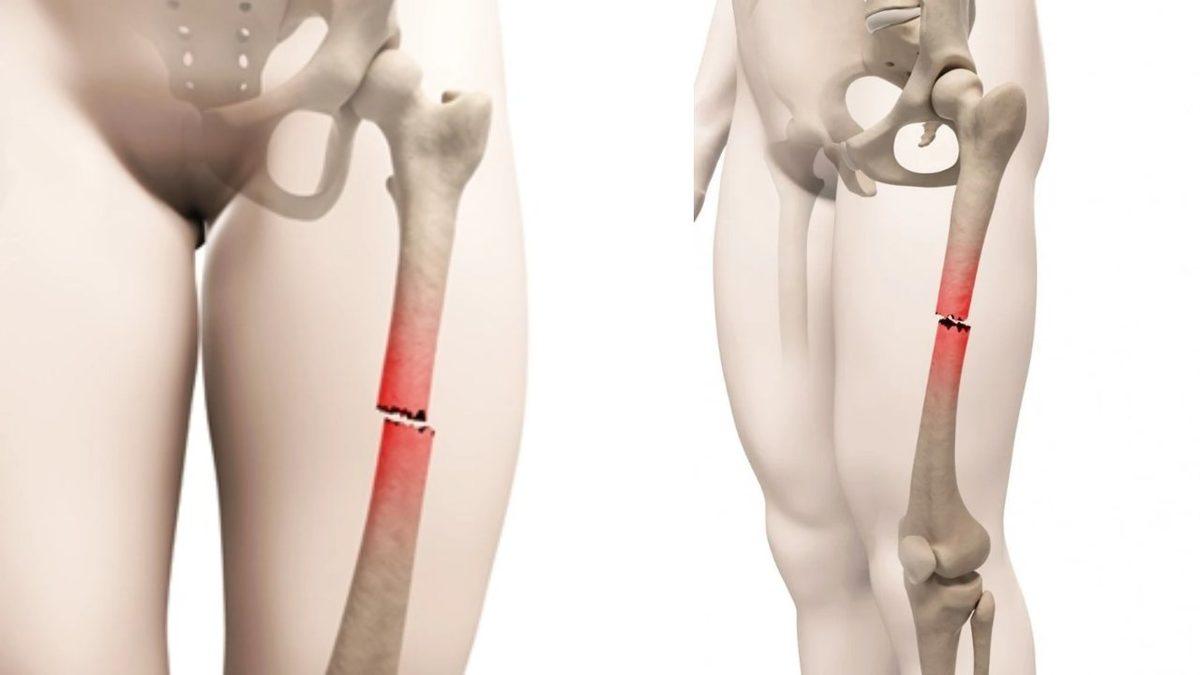 Bilmenizde Fayda Var: İnsan Vücudundaki En Büyük ve En Küçük Kemikler Hangileridir?