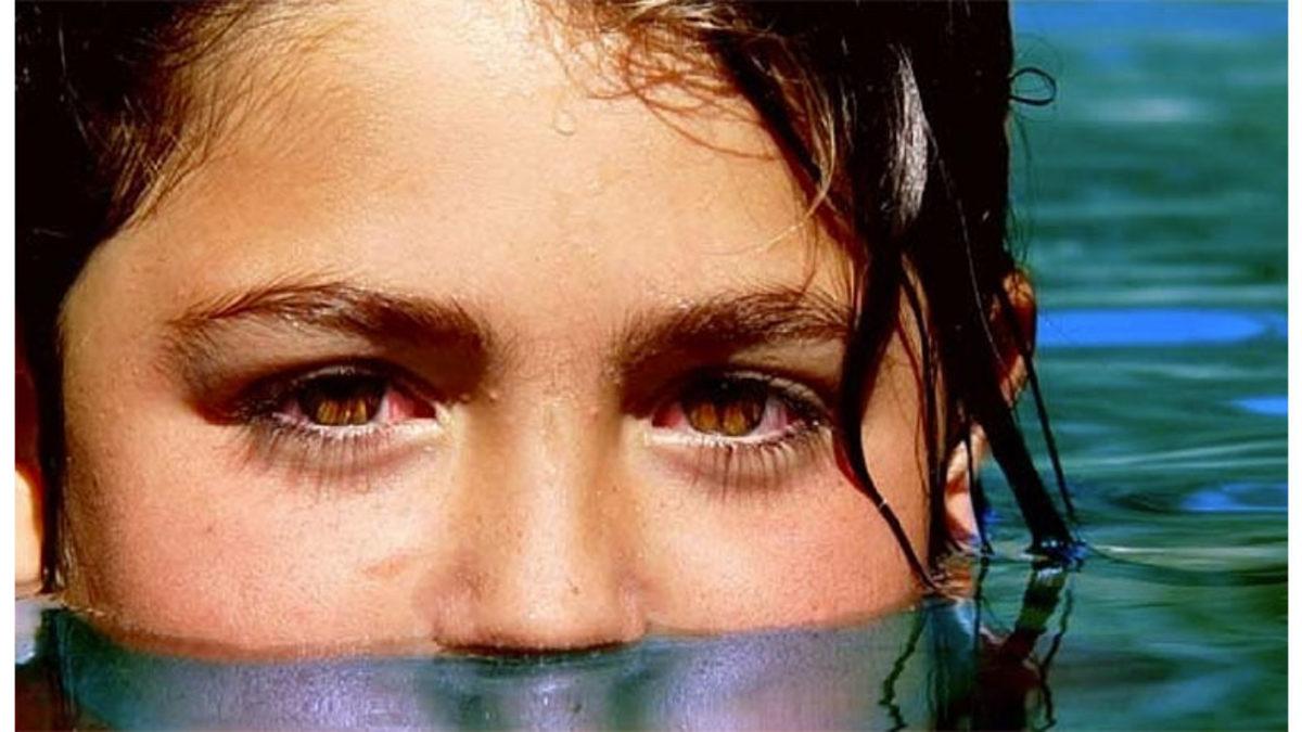 Havuzdayken Gözlerimizin Kırmızıya Dönmesinin Artık Girerken İki Kere Düşündürecek Sebebi