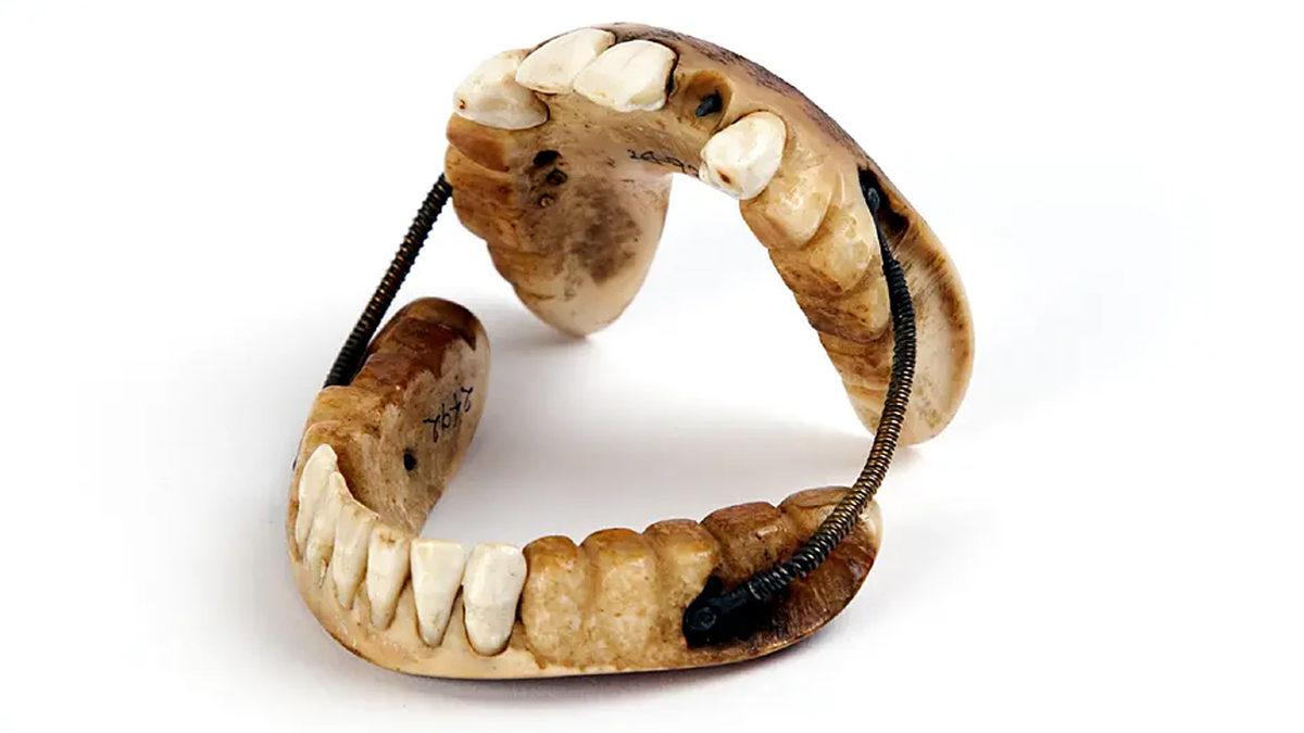 Mide Kaldırır!: Eski Zamanlarda Protez Dişlerin ve Diş Beyazlatmanın Nasıl Yapıldığını Öğrenince Günümüz Teknolojisine Bir Kere Daha Teşekkür Edeceksiniz