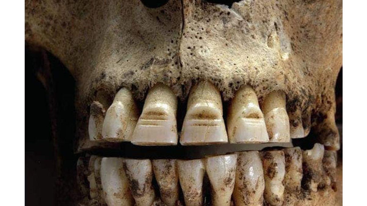 İçiniz Bir Hoş Olabilir: Vikingler Neden Kendi Dişlerini Bile İsteye Oyuyorlardı?