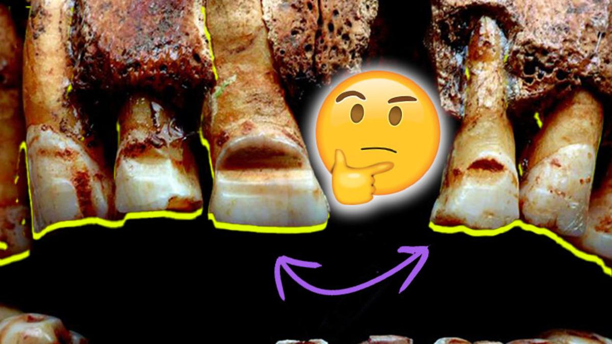 İçiniz Bir Hoş Olabilir: Vikingler Neden Kendi Dişlerini Bile İsteye Oyuyorlardı?