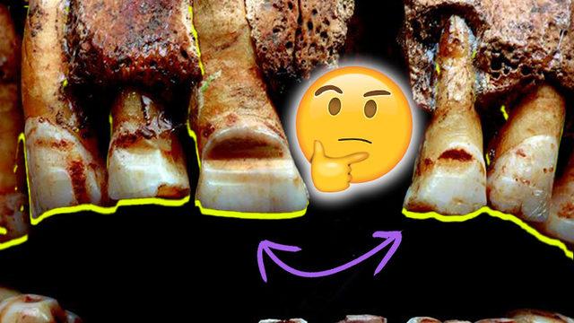 İçiniz Bir Hoş Olabilir: Vikingler Neden Kendi Dişlerini Bile İsteye Oyuyorlardı?