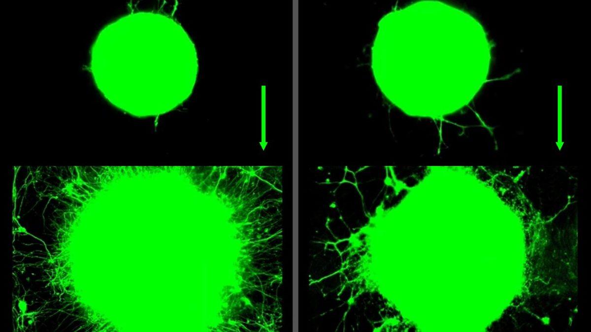Düzenli Egzersizin, Hasarlı Nöronlar Üzerindeki Muazzam Etkisini Öğrenince Soluğu Spor Salonunda Alabilirsiniz!