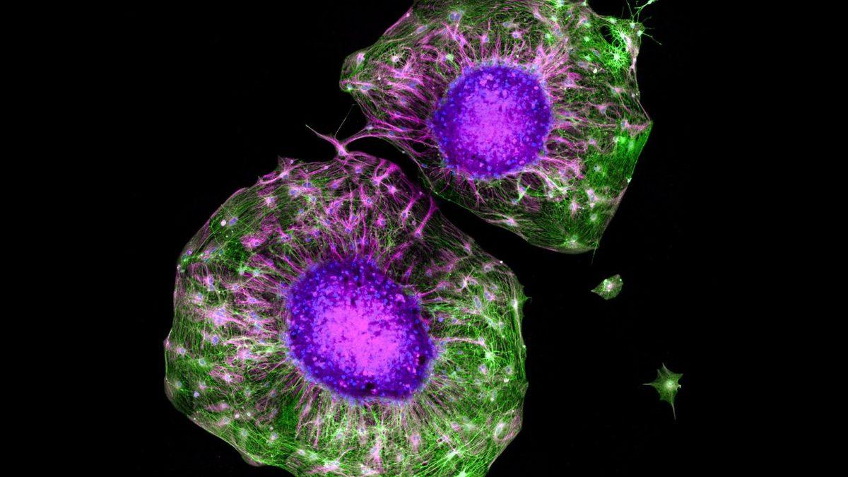 Düzenli Egzersizin, Hasarlı Nöronlar Üzerindeki Muazzam Etkisini Öğrenince Soluğu Spor Salonunda Alabilirsiniz!