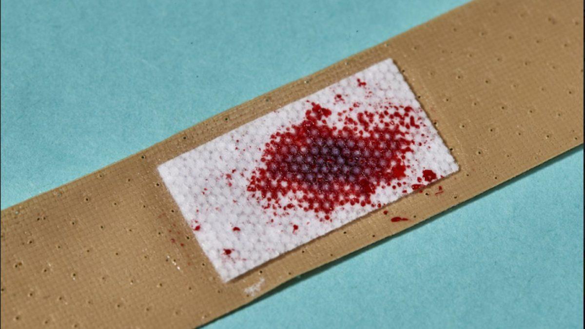 Bazı İnsanlar Kan Gördüklerinde Neden Bayılırlar? (Beyninizle Bir İlgisi Var!)