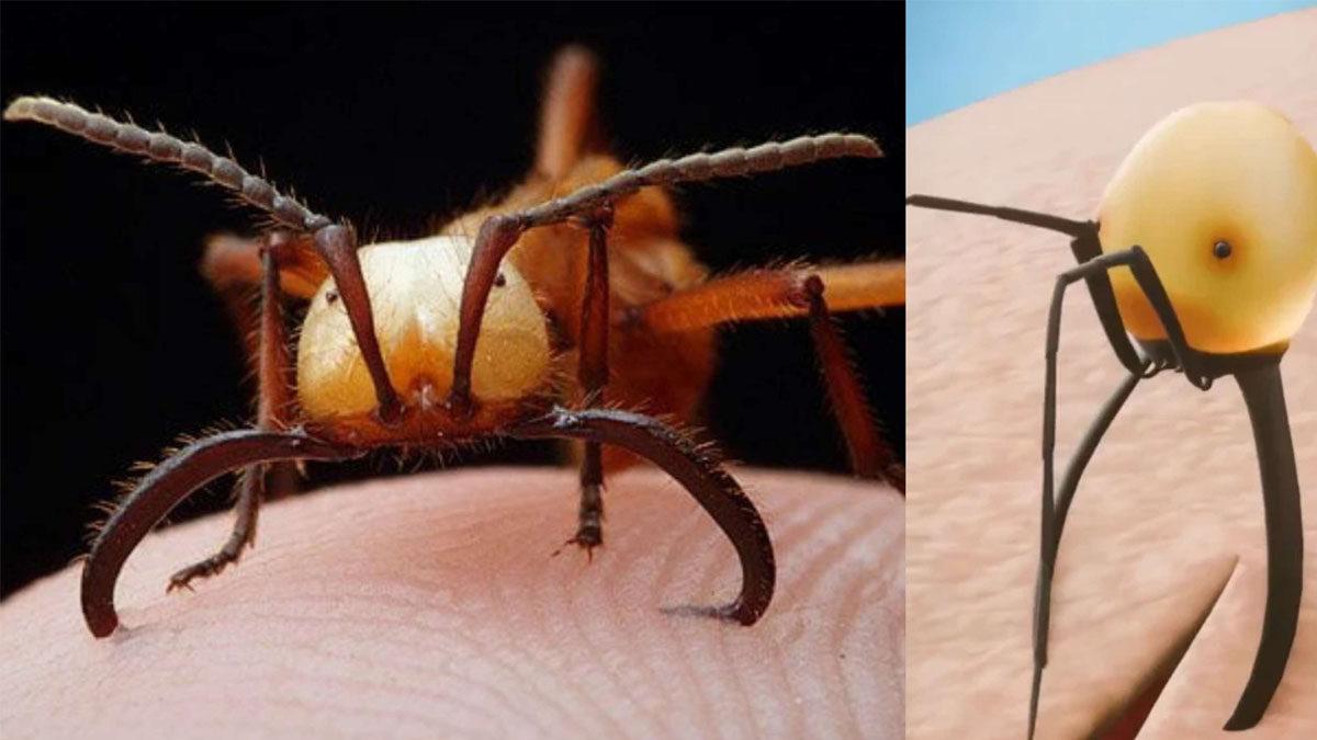 Eski Çağlarda İnsanlar Yaralarını Tedavi Etmek İçin Nasıl Karıncalara Dikiş Attırıyordu? (Şaka Değil Gerçek!)